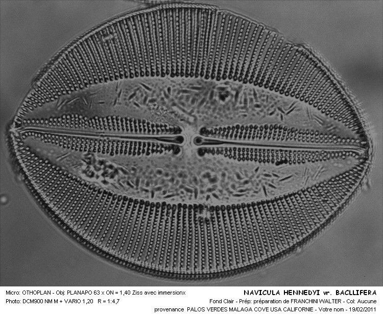 Lyrella hennedyi (W.Smith) D.G.Mann var.bacillifera #20704