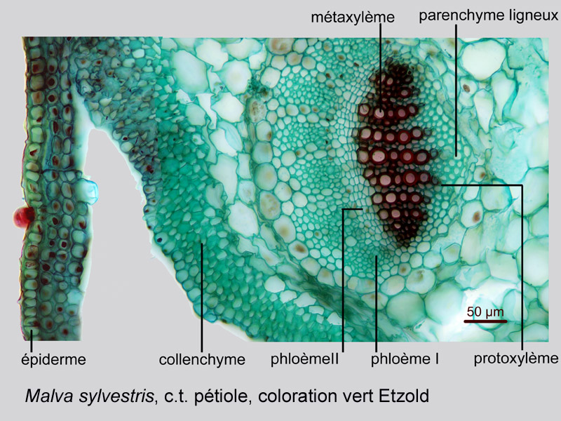 Malva sylvestris, Puccinia m., histologie, histology. #20601