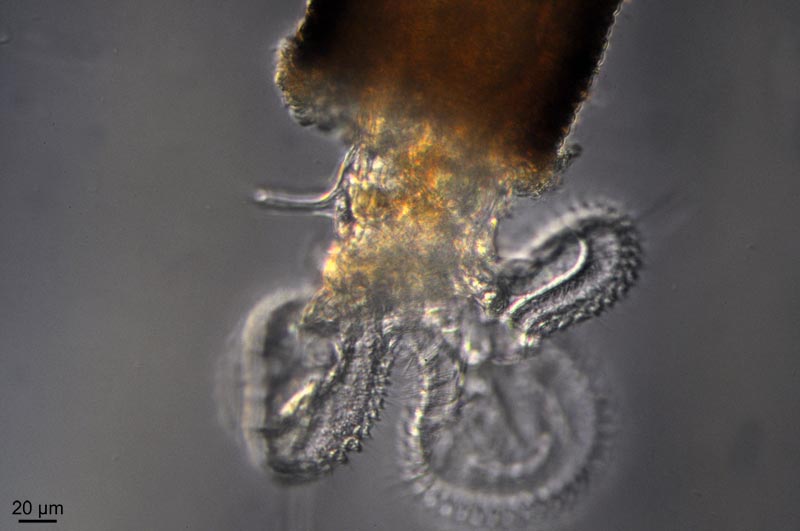 Melicerta ringens (Linnaeus, 1758) [=Floscularia ringens] #46657