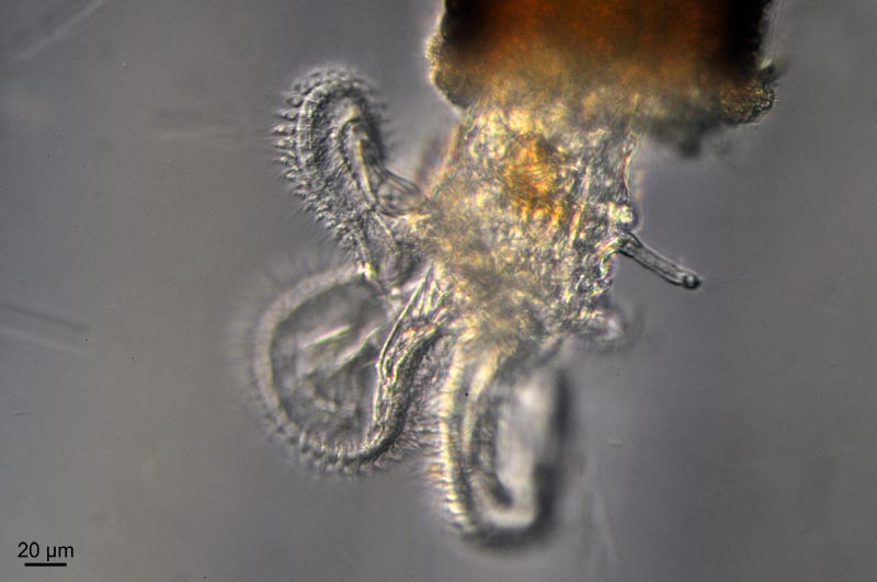 Melicerta ringens (Linnaeus, 1758) [=Floscularia ringens] #46658