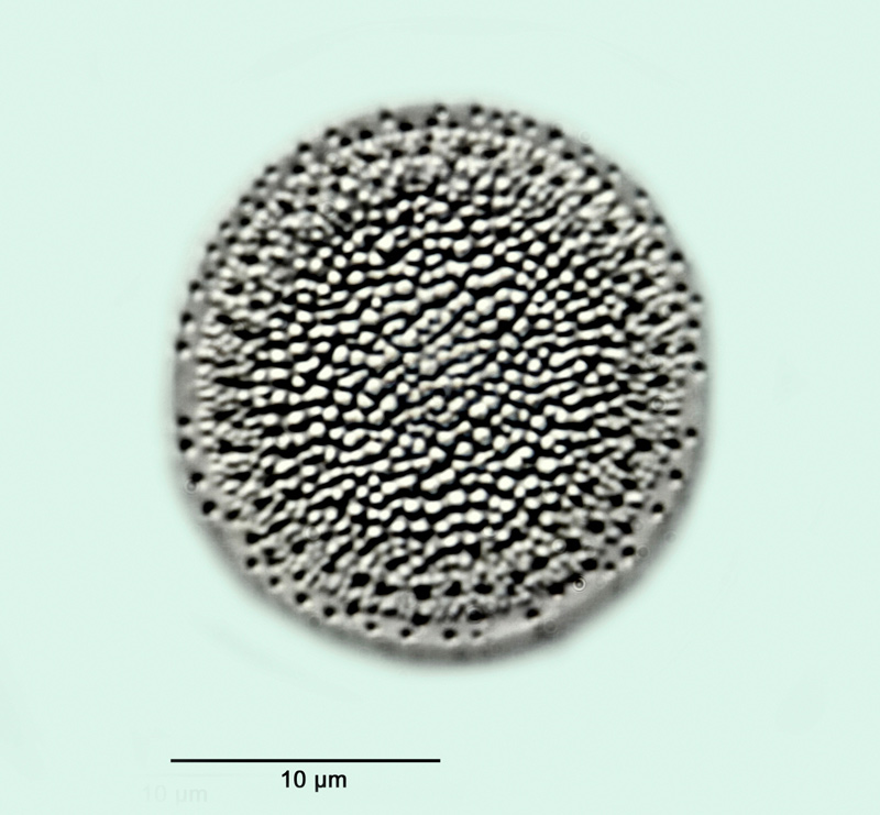 Melosira bituminosa var. dilatata Pantocsek #30746