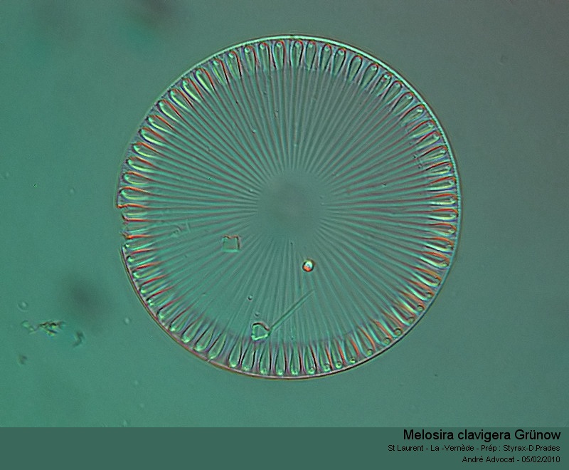 Melosira clavigera Grünow #18149