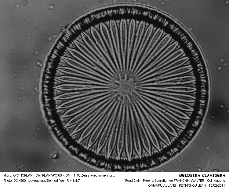 Melosira clavigera Grunow #20593