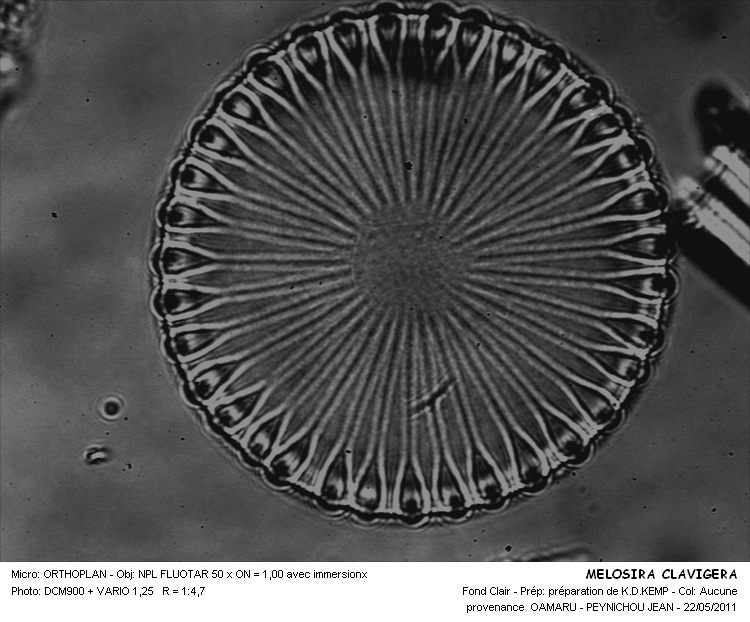 Melosira clavigera Grunow #22447