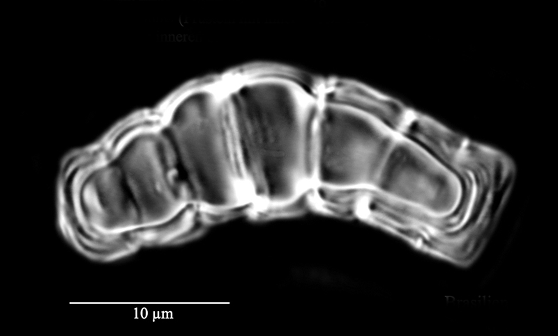 Melosira dickiei #71771