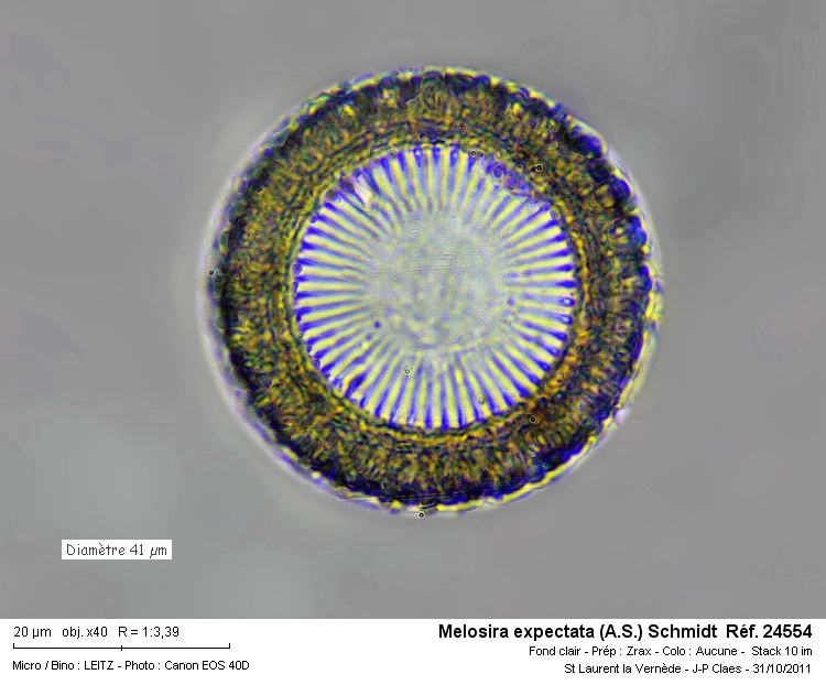 Melosira expectata #24955
