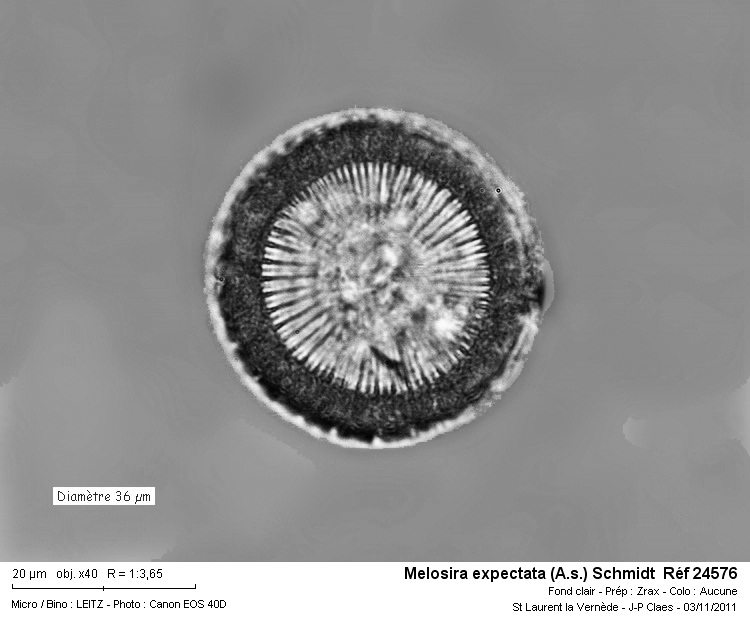 Melosira expectata #24954