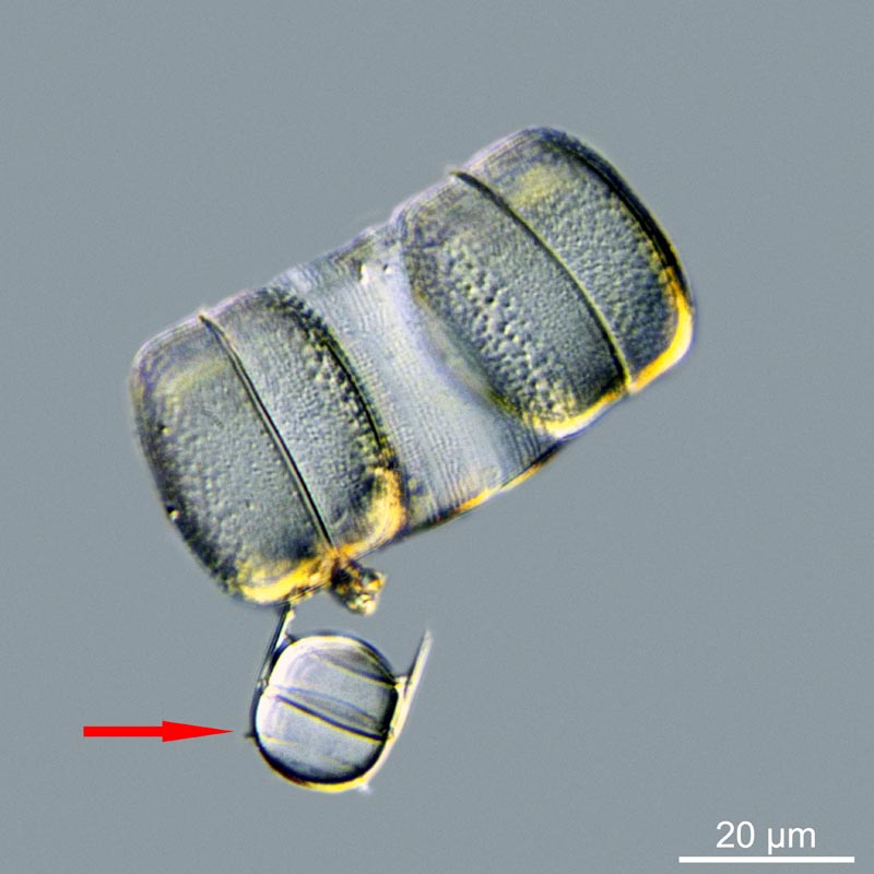 Melosira moniliformis (O.F. Müller) C. Aghard, 1824 #49313