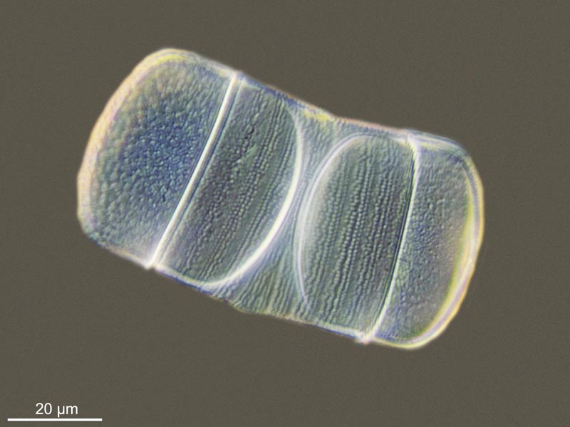 Melosira moniliformis (O.F. Müller) C. Aghard, 1824 #49312