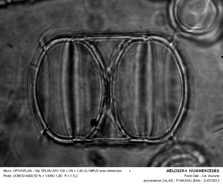 MELOSIRA NUMMULOIDES #32832