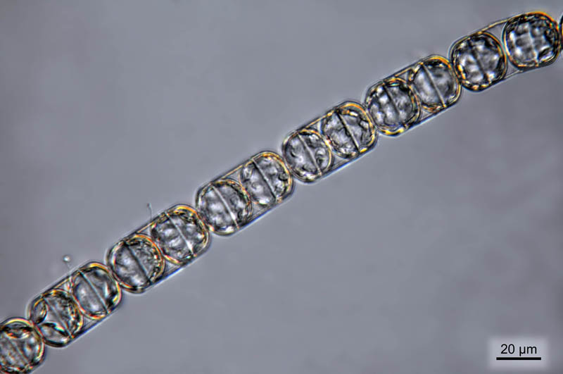 Melosira nummuloides #30367