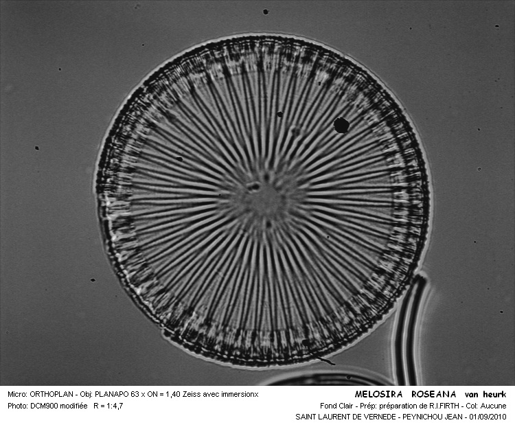 MELOSIRA ROSEANA #31970