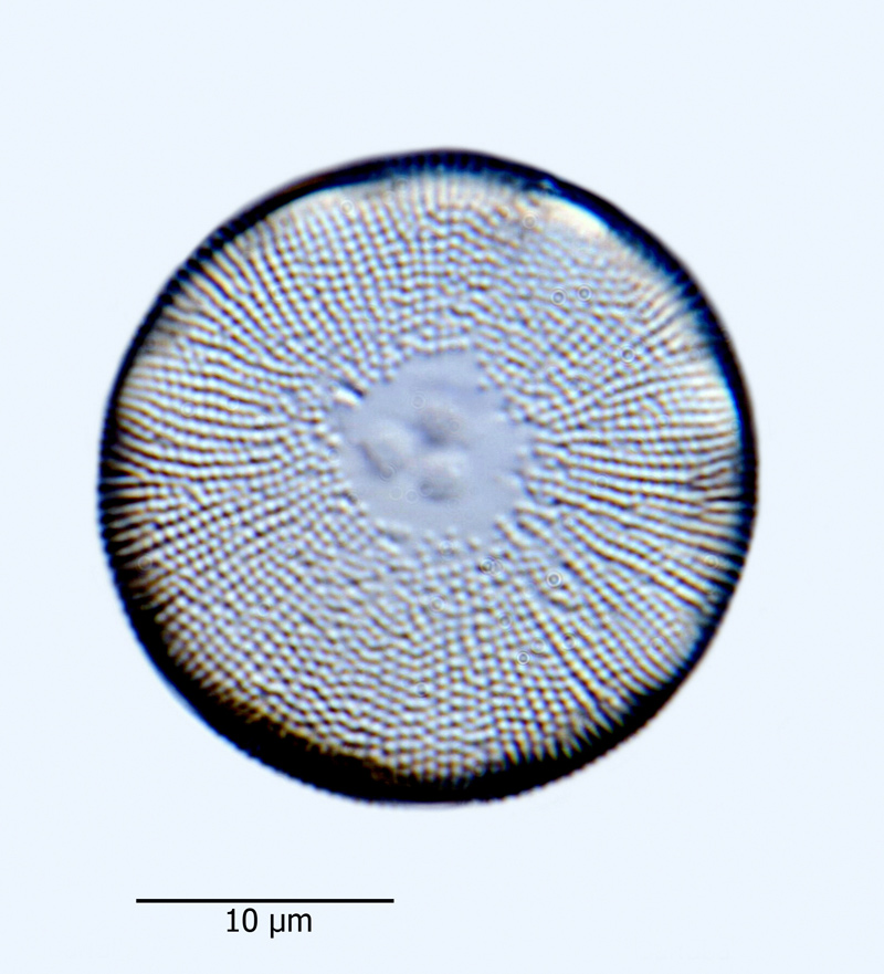 Melosira roseana #43173