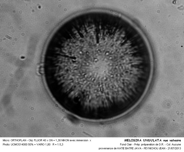 MELOSIRA UNDULATA #32816
