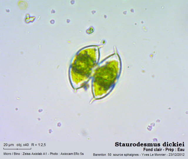 Micrasterias dickiei (ex Staurodesmus) #73370