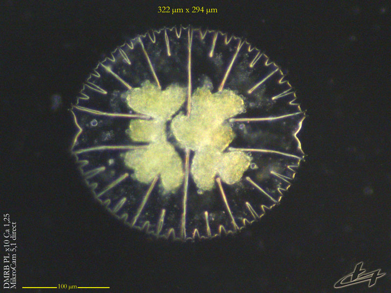 Micrasterias rotata Ralfs #80062