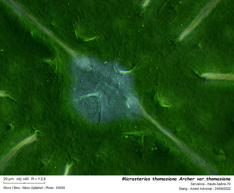 Micrasterias thomasiana Archer var. thomasiana #72114