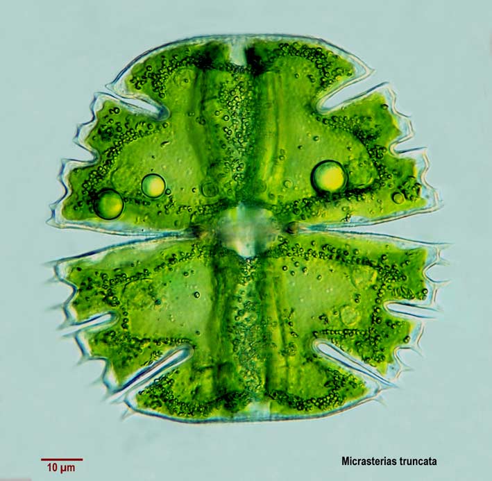 Micrasterias truncata #4871
