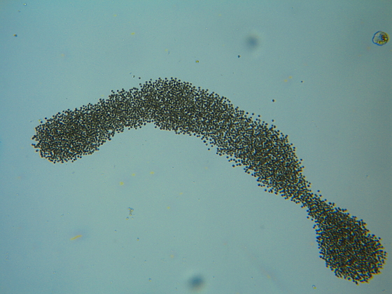 Microcystis-colonie #5478