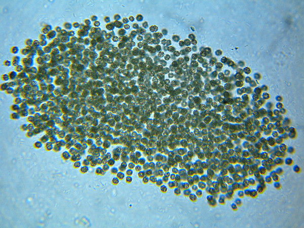 Microcystis-colonie #5480