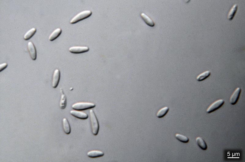 Mollisia sp. #31168