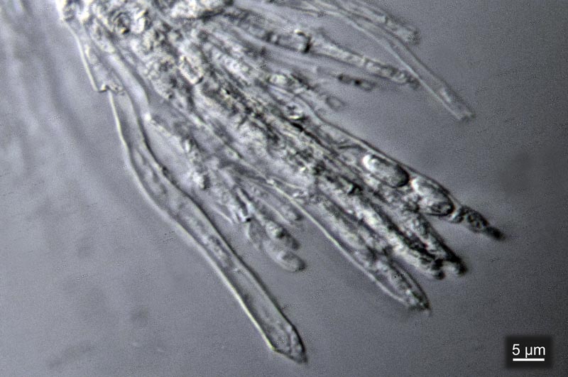 Mollisia sp. #31166