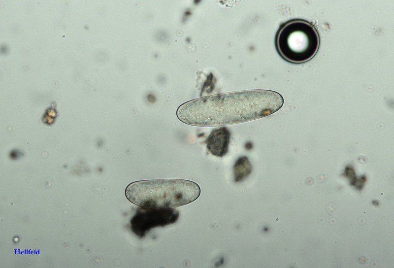 Morchella elata spores #35372
