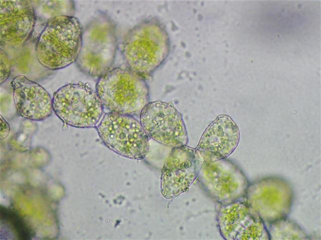 Mylia anomala (Hook.) Gray #65322
