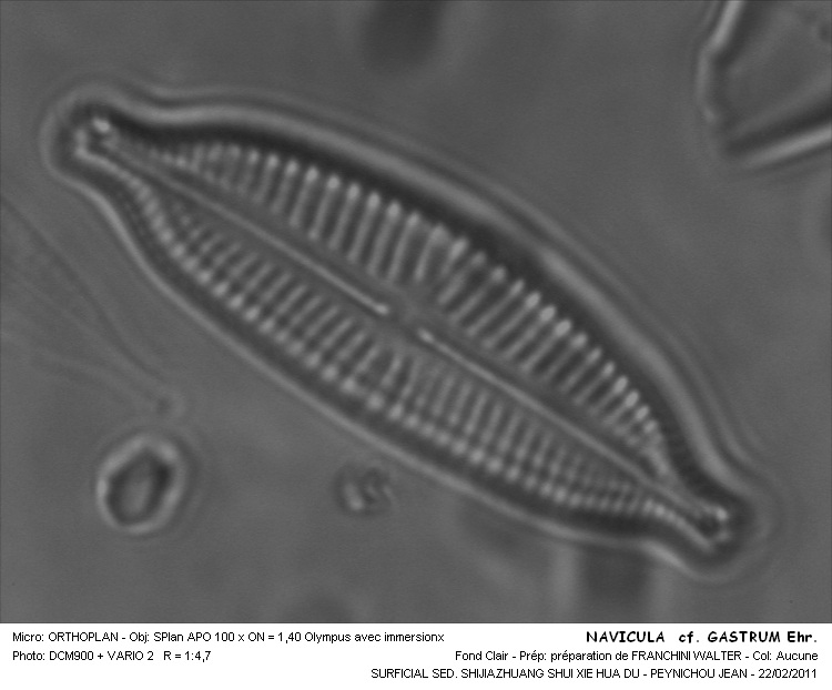 NAVICULA cf GASTRUM #31944