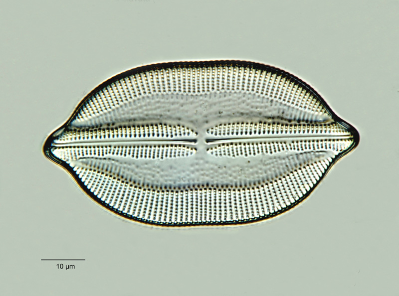 Navicula clavata Gregory forma indica (Grev.) Cleve #18788