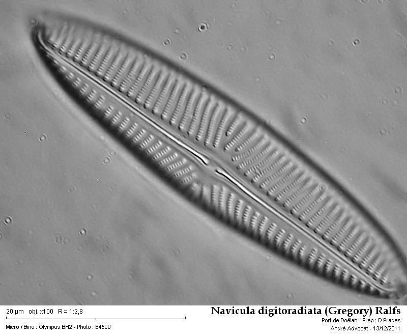 Navicula digitoradiata (Gregory) Ralfs #25169