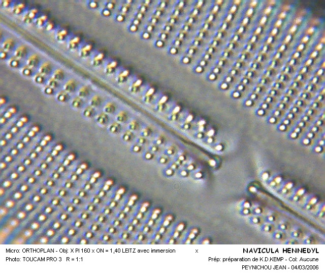 NAVICULA HENNEDYI #31876