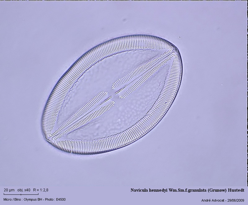 Navicula hennedyi Wm.Sm.f.granulata (Grunow) Hustedt #11462