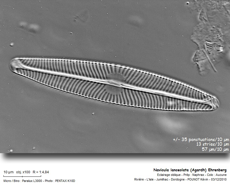Navicula lanceolata (Agardh) Ehrenberg #19372