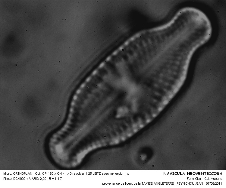 NAVICULA NEOVENTRICOSA #31823