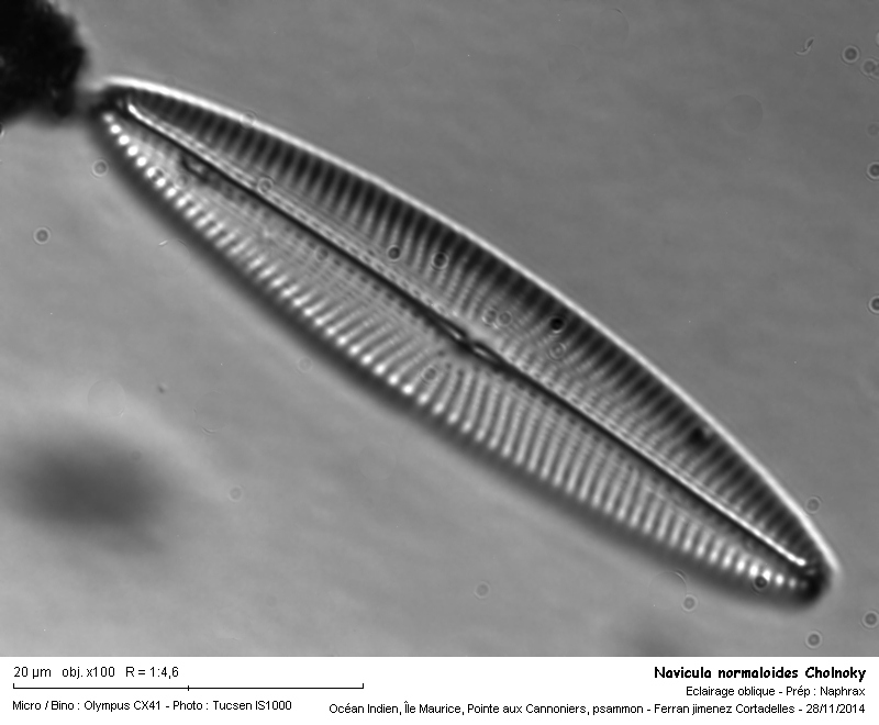 Navicula normaloides Cholnoky #44547