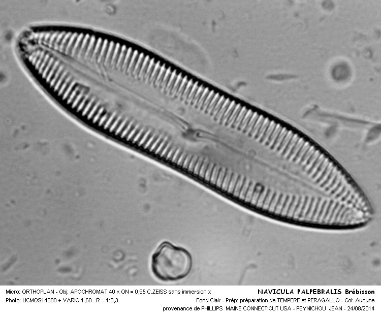 NAVICULA PALPEBRALIS Breb. #38600