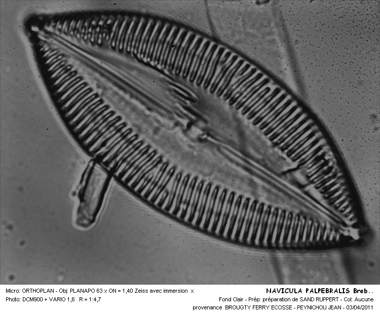NAVICULA PALPEBRALIS Breb. #31810