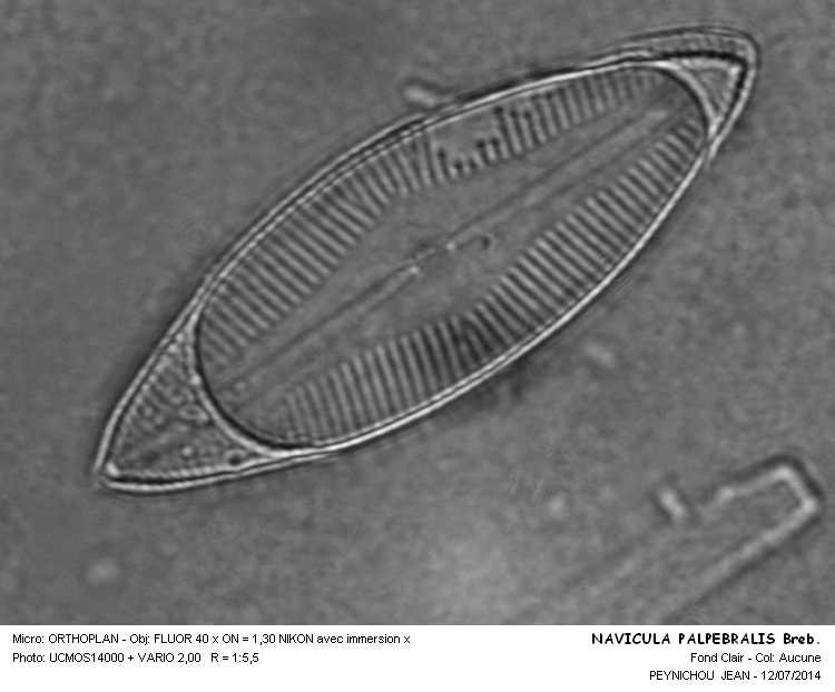 NAVICULA PALPEBRALIS Breb. #38185