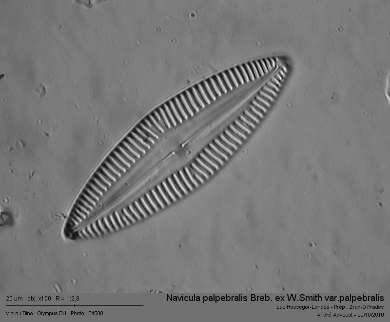 Navicula palpebralis Breb.ex W.Smith var.palpebralis #18641