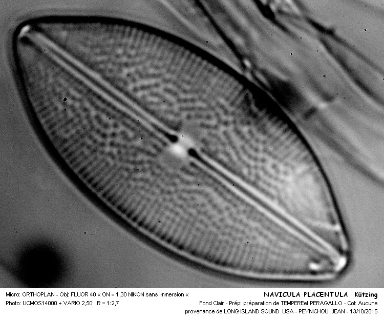 NAVICULA PLACENTULA Kützing #42308