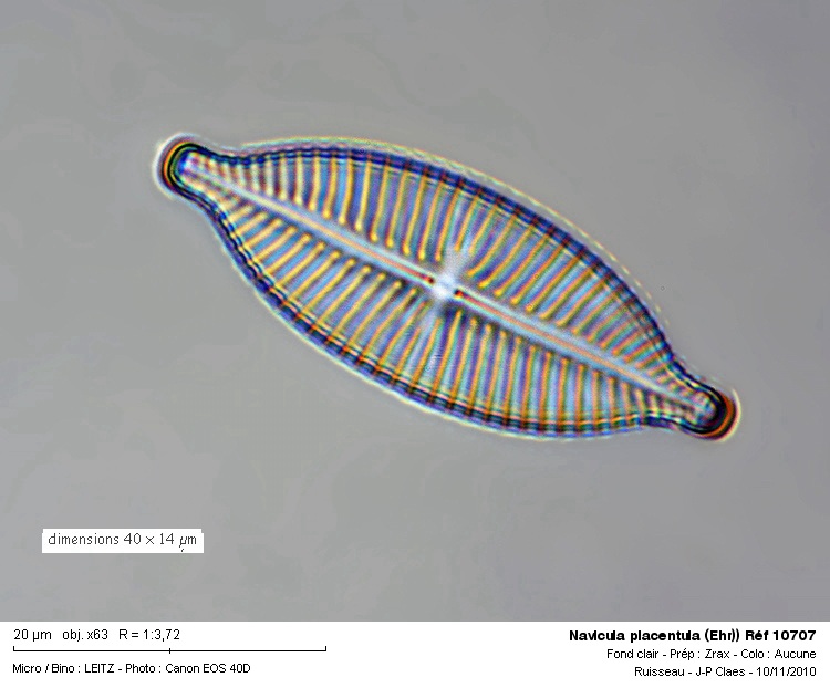 Navicula placentula (Ehr) #19117