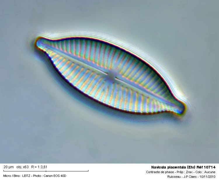 Navicula placentula (Ehr) #19118