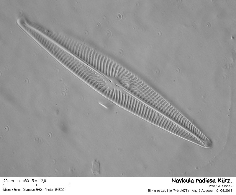 Navicula radiosa Kützing   (Lac Inlé ) #31555