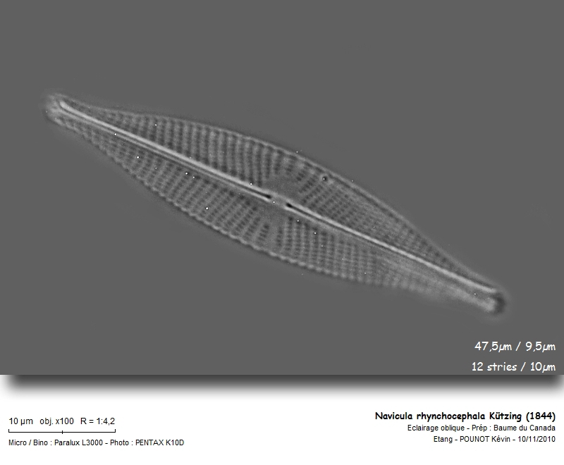 Navicula rhynchocephala Kützing (1844) #19046