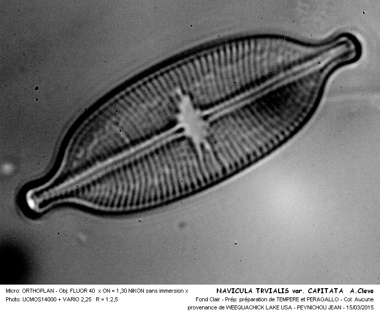 NAVICULA TRIVALIS var. CAPITATA A. Cleve #40850