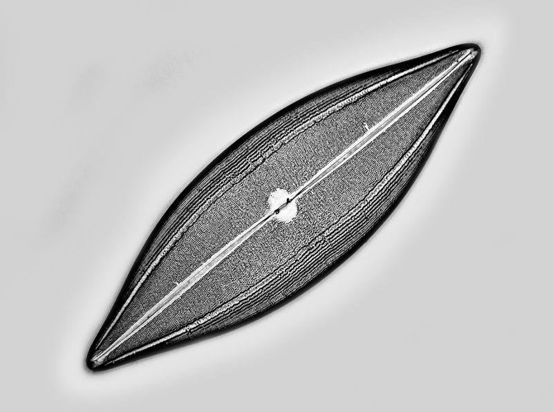 Neïdium  tumescens (Grun.) Cl. var. tumescens #49536