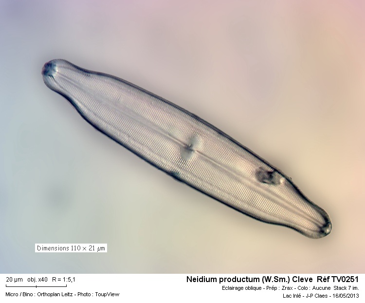 Neidium productum (Lac d Inlé) #31071