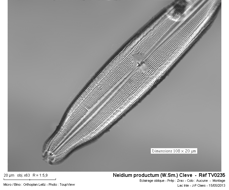 Neidium productum (Lac d Inlé) #31072