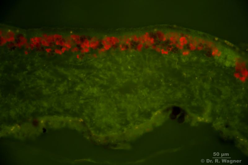 Nephroma laevigatum #28915
